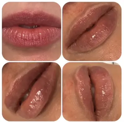 lek.med. Iwona Sułecka Gabinet Medycyny Estetycznej , Reumatologii i Chorób Wewnetrzyxh